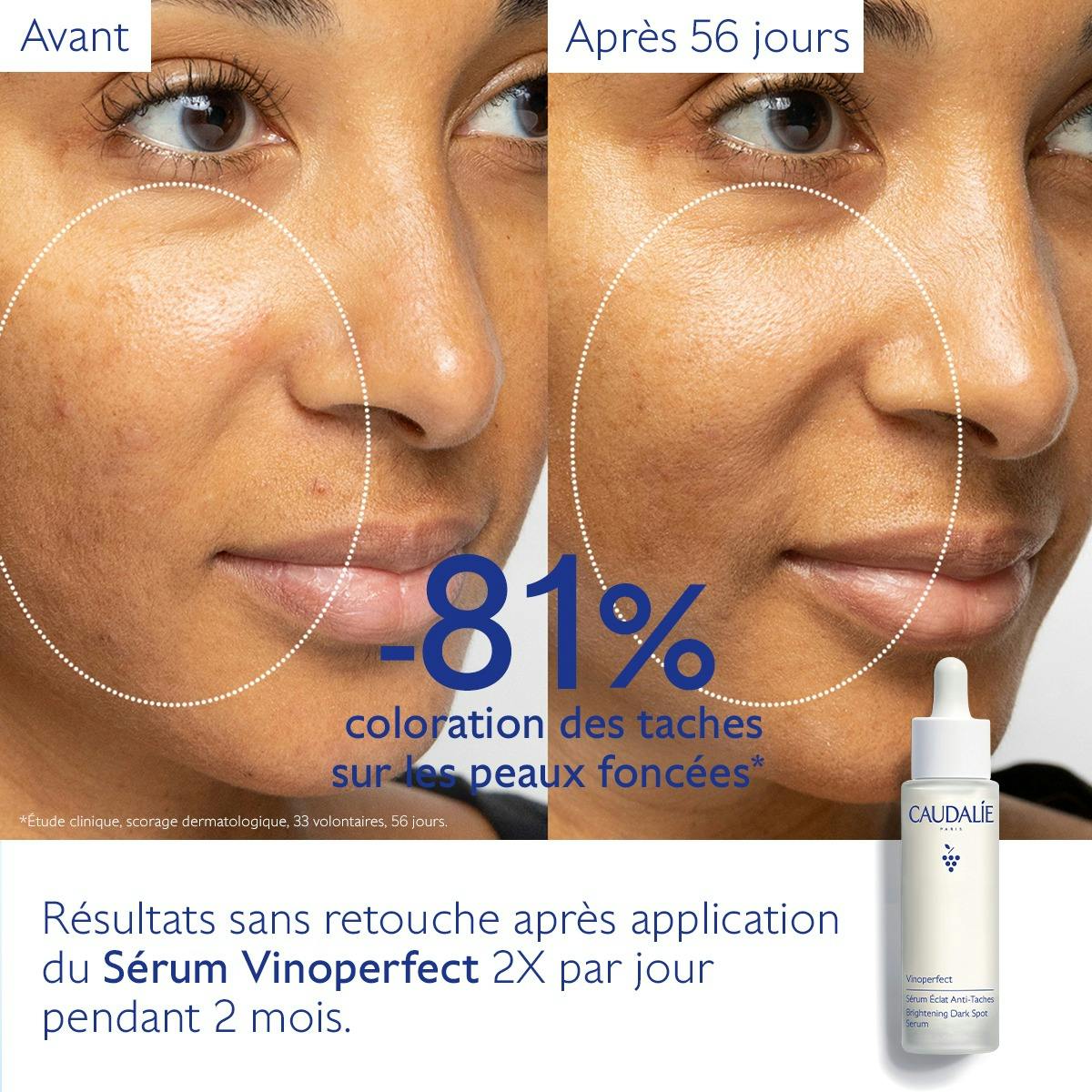 Sérum Éclat Anti-Taches à la Viniférine, alternative à la Vitamine C - Grand Format