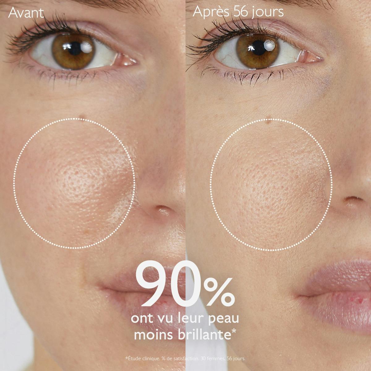 Lotion Purifiante à l'Acide Salicylique - 200mL