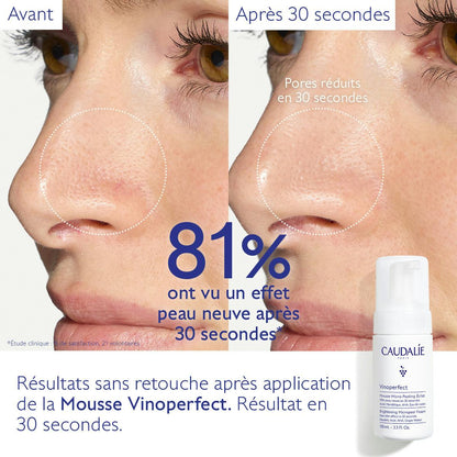 Mousse Micro-Peeling Éclat à l'Acide Mandélique (AHA) - 100ml